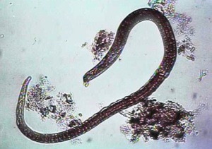 Trichinella Spiralis